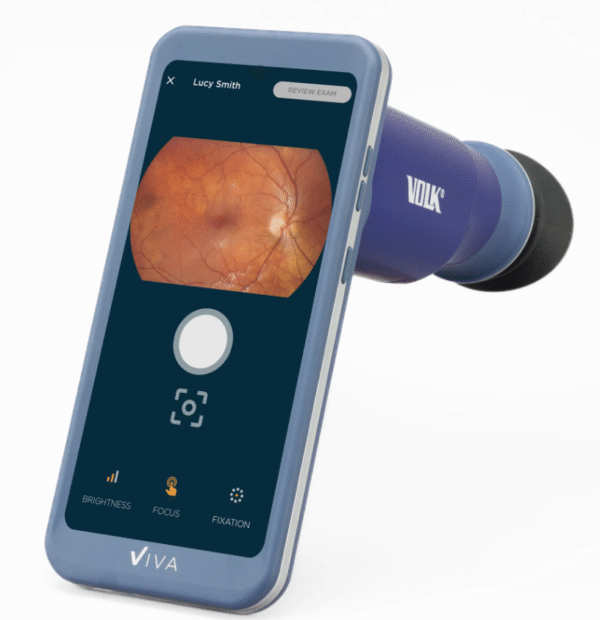 Volk Viva Fundus Camera - Image 2
