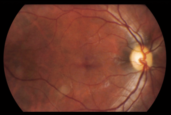 Volk Viva Fundus Camera - Image 8